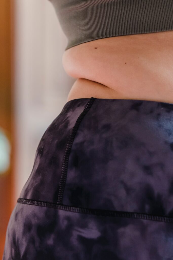 Obesity and PCOS